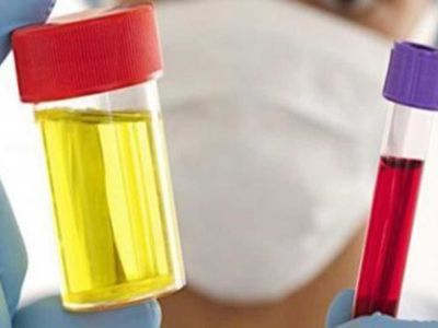 İdrarda Hemoglobin nedir, neden yükselir? Hemoglobin yükselme belirtileri