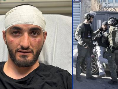 İşgalci İsrail polisleri Türk gazeteciye saldırdı: Tekmeleyerek darp ettiler