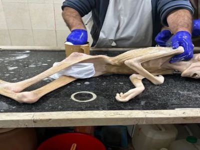 İsrail’in insanlık dramı pes dedirtti! Filistinli Yezen’den geriye bir deri bir kemik fotoğrafları kaldı…