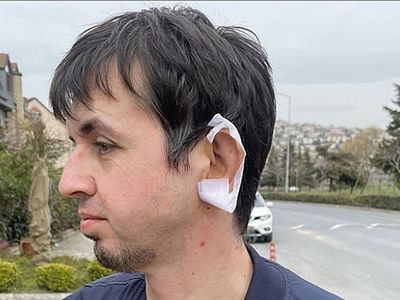 İstanbul'da köpek dehşeti bitmiyor! Genç adama tam 20 dikiş atıldı