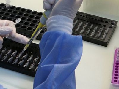 Japon Araştırmacılar Kovid-19'u 5 Dakikada Saptayabilen Test Yöntemini Buldu