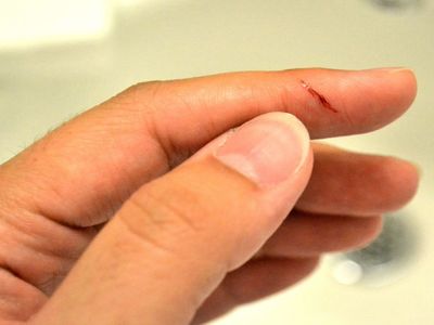 Kağıt kesiğinin dayanılmaz acısının sırrı ortaya çıktı: Meğer bu yüzden canımızı çok yakıyor