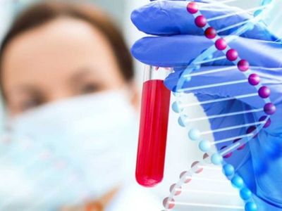 Kan grubu nasıl öğrenilir? Kan grubu testine aç karnına mı gidilir? Kan grubu internetten öğrenilir mi?  Kan grubu test sonucu öğrenme