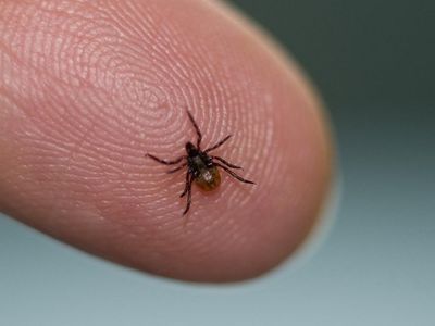 Kene ısırması ilk yardım ve tedavisi nedir? Kene ısırdığında neler yapılmalı?