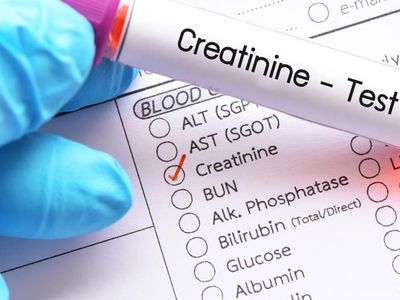 Kreatinin Nedir?