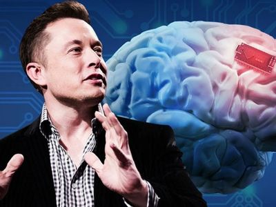 Kurgu filmleri gerçek oldu: Elon Musk ilk kez bir insana beyin çipini yerleştirdi!