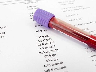 Lipaz enzimi normal değeri kaç olmalı? Lipaz değeri yüksekliği ve düşüklüğü tedavileri