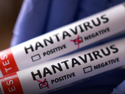 Madrid’de Hantavirüs Alarmı: Tahliye Edilen Yolculardan Birinde Virüs Tespit Edildi