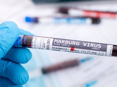 Marburg virüsü nedir, ölümcül mü? Marburg virüsü belirtileri neler, tedavisi var mı? Dünyanın en ölümcül virüsü yeniden ortaya çıktı