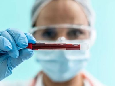 MCHC kan tahlili nedir, neden istenir? MCHC hangi durumlarda artar? MCHC yüksekliği ve düşüklüğünün etkileri