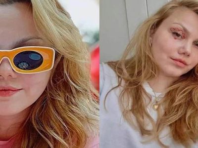 Merve Veziroğlu kimdir, nereli ve kaç yaşında? Youtuber Merve Veziroğlu neden gündemde, sağlık durumu nasıl?