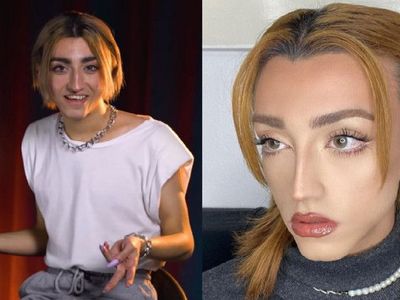 Mika Can Raun aslen nereli? Mika Türk mü? Mika Raun estetik olmadan önceki hali? Estetik oldu mu?