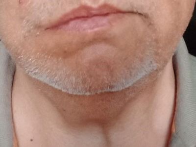 Pamukkale Turizm muavini su isteyen doktoru yaraladı