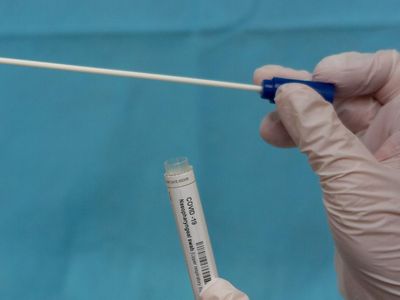 PCR Testi Nedir, Ücretli mi?