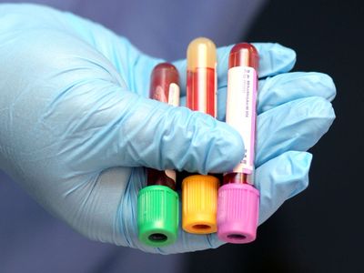 PCT Yüksekliği Nedir, Nedenleri Neler? 
