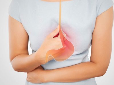 Reflü nedir, belirtileri nelerdir? Reflüyü ne tetikler? Reflü hastaları için beslenme önerileri