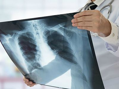 Rusya'da Skandal Olay! Röntgen Çektirmeye Giden Hastalar Hayatını Kaybetti