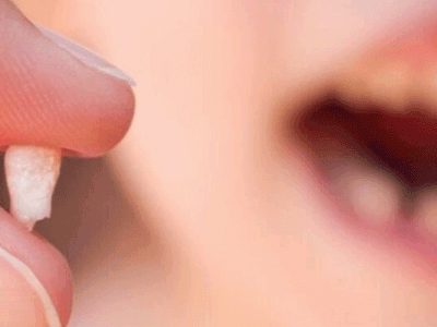 Rüyada Diş Dökülmesi Ne Demek?