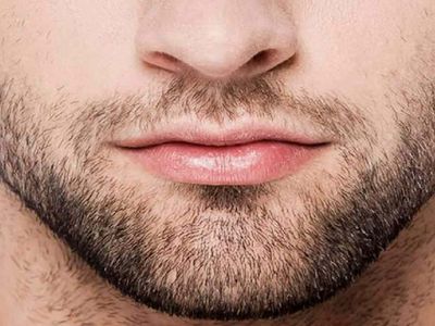 Sakal çıkması için neler yapılabilir? Sakal çıkartmak için uygulanabilecek doğal yöntemler