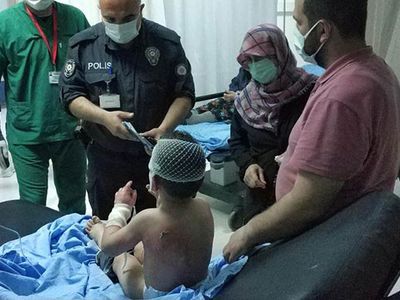 Samsun’da Mangala Benzin Dökülmesi Sonucu 1'i Çocuk 2 Kişi Yaralandı