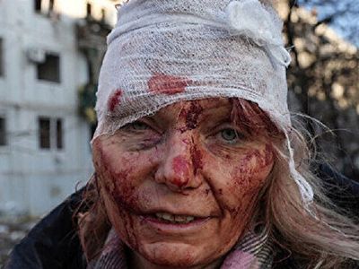 Savaşın Ağır Bilançosu Gün Ağarınca Ortaya Çıktı: Yüzlerce Ölü Ve Yaralı Var
