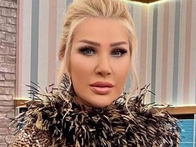 Seda Sayan estetiğe doymuyor! Dudak slikonlarını yenileten Seda Sayan'ı görenler "Ne zaman duracaksın Seda?" dedi