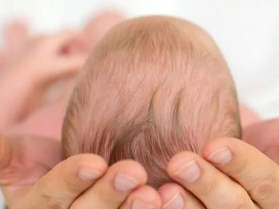 SMA Hastalığı Genetik mi, SMA Hastalığı Çeşitleri Nelerdir?