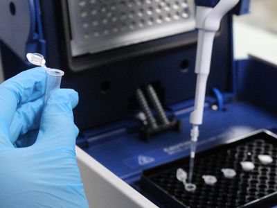 SMA Testi Nasıl Yapılır?