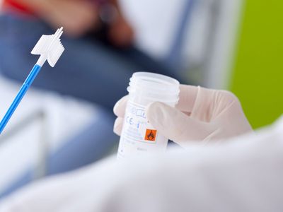 Smear testi nedir, nasıl yapılır?