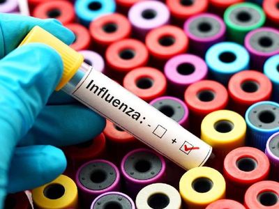 Son günlerin en yaygın hastalığı: Uzmanlardan influenza uyarısı! İşte influenzadan korunma yolları