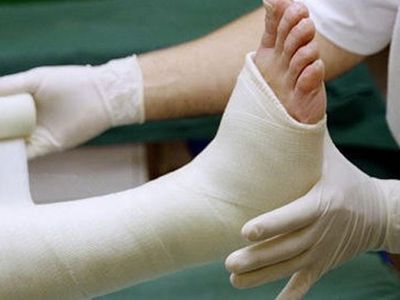 Tarak Kemiği Kırığı Ne Zaman İyileşir, Ayak Tarak Kemiği Kırığı Tedavisi Kaç Hafta Sürer?
