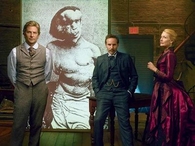 The Elephant Man – Fil Adam film konusu ve oyuncuları
