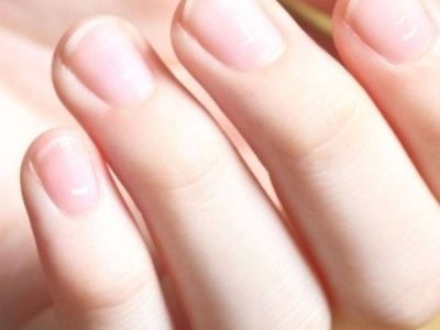 Tırnaklardaki beyaz leke neden olur? Tırnaklarda beyaz leke için çözüm önerileri
