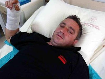 Tokat’ta Ayı Saldırısına Uğrayan Adamın Mücadelesi Yürekleri Ağza Getirdi: Ayı Saldırısından Güreşerek Kurtuldu