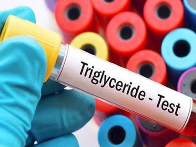 Trigliserid Nedir, Trigliserid Yüksekliği Nasıl Düşürülür? 