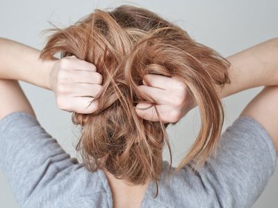 Saç Koparma Hastalığı Nedir, Nasıl Tedavi Edilir?