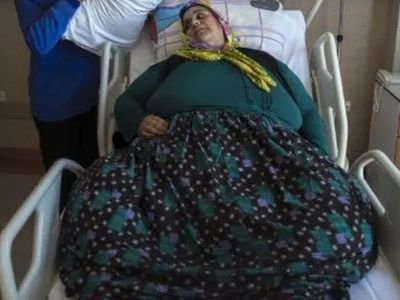 Türkiye’nin en kilolu kadını: 22 yıldır obeziteyle mücadele ediyor!
