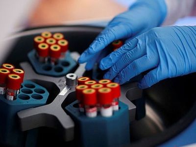 Uzman İsim Açıkladı: Koronavirüs 6 ile 9 Ay İçinde Bitebilir