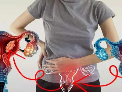 Vajina kanseri nedir, nasıl olur? Vajina kanseri belirtileri ve tedavi yöntemleri
