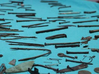 Van'da akıllara durgunluk veren olay! Genç kadının midesinden 158 parça metal çıkarıldı