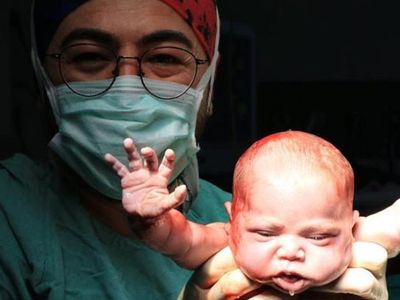 Van’da Burçak Bebek Birinciliği Getirdi