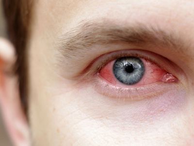 Vitrektomi Ameliyatı Nedir?