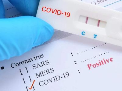 Yerli Ve Milli Kovid-19 Tanı Kiti,30 Dakikada Sonuç Veriyor! Kısa sürede sonuç veren bu test güvenilir mi?