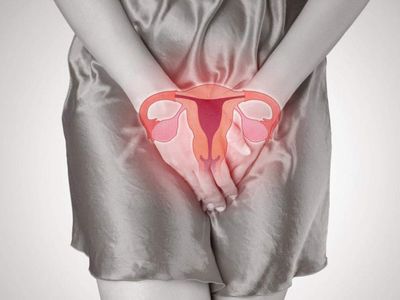 Yumurtalık iltihabı tehlikeli mi, kendiliğinden geçer mi? Yumurtalık iltihabı doğal çözümü var mı?
