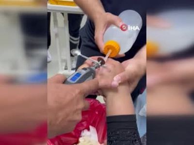 Yüzüğü parmağına sıkışan kadının yardımına itfaiye ekipleri koştu