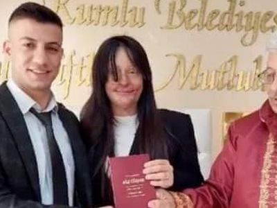 Yüzünü Asitle Yakan Sevgilisini Affeden Berfin Özek Ozan Çeltik'le Evlendi