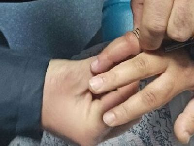 Amasya'da Yüzüğü Parmağına Sıkışan Kadının Yardımına İtfaiye Koştu