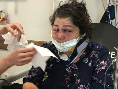 CHP’li Belediye Başkanına Skandal İddia; 'Park Bakımsız’ Diyen Kadını CHP’li Başkanın Korumaları Darp Etti