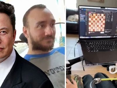 Elon Musk görüntüleri paylaştı: Felçli gencin beynine çip yerleştirildi sonrası tam bir mucize!