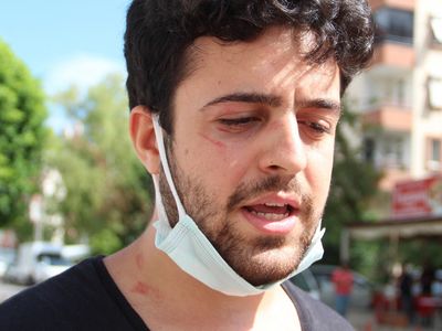 Köpeklerini Gezdiren Genç Sokak Ortasında Saldırıya Uğradı